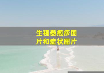 生稙器疱疹图片和症状图片