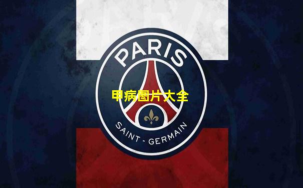 甲病图片大全